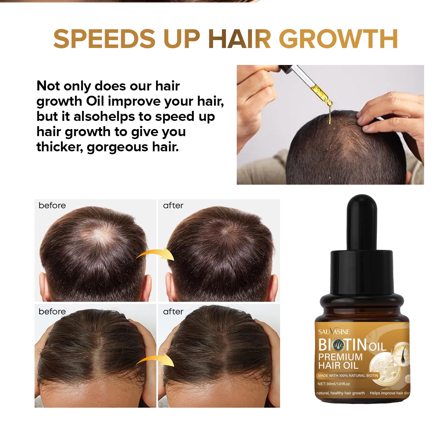 Advertisement for hair growth oil showing before and after effects on hair, with a bottle of the product.