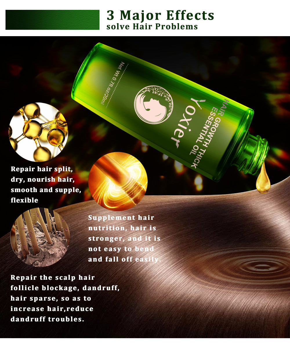 Green bottle of Yoxer hair oil with text describing its effects on hair problems.