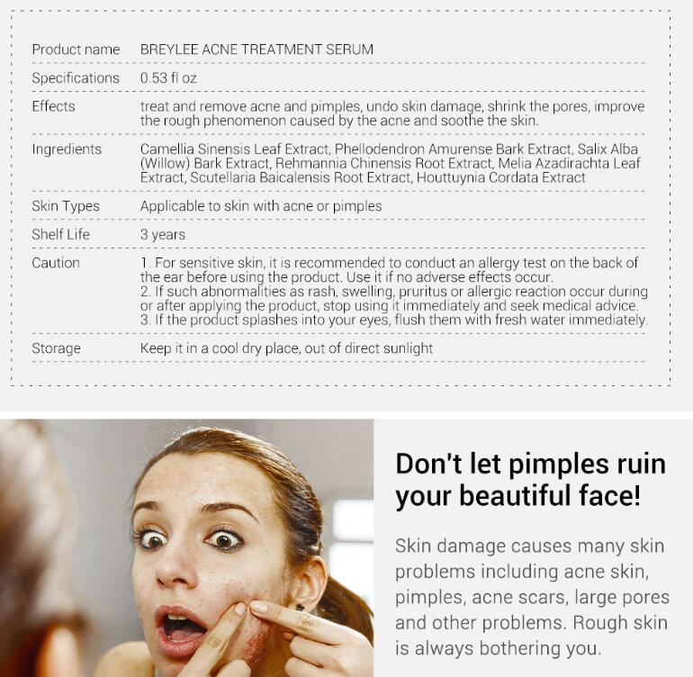 Acne treatment serum product information with a woman examining her face.