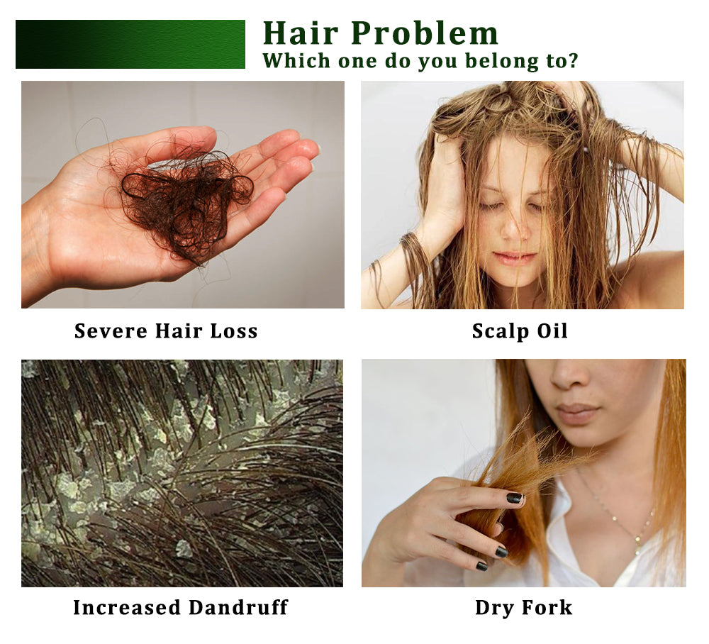 Hair care product advertisement with images of hair issues and a person applying oil.