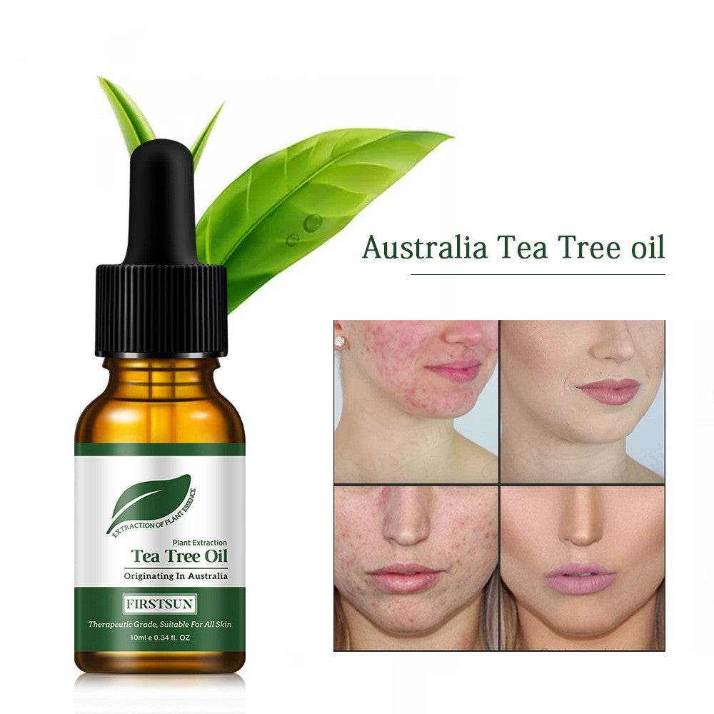 Tea tree oil bottle with dropper and before-and-after skin treatment images on a white background