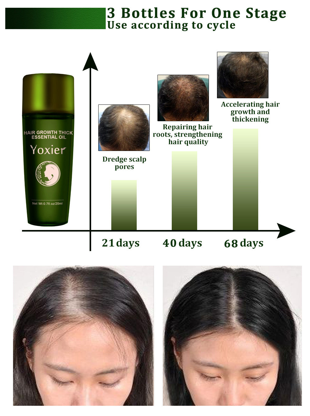 Yoxier hair growth essential oil with before and after hair growth results on a white background