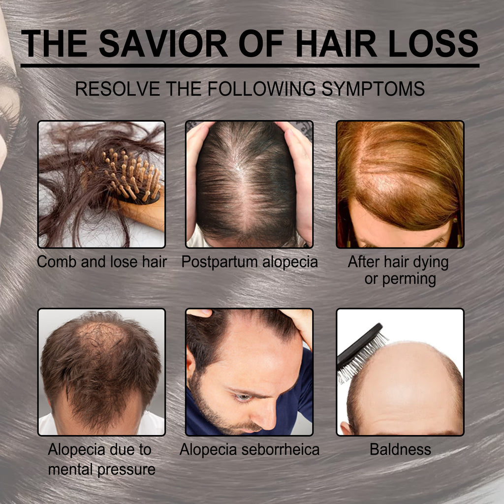 Advertisement for hair loss solutions with images of hair issues and scalp care.