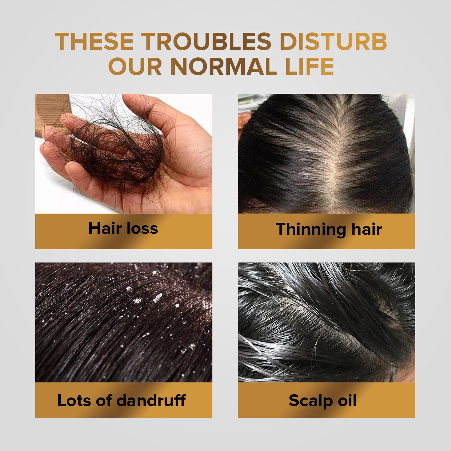 Illustration of hair issues including hair loss, thinning hair, dandruff, and scalp oil on a gray background.