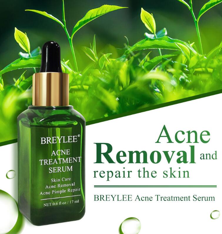Bottle of Breylee Acne Treatment Serum with green leaves in the background