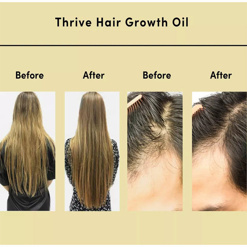 Before and after comparison of hair growth using Thrive Hair Growth Oil on a beige background.